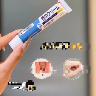Kem bôi trĩ SWAN SECRET hỗn hợp bên trong và bên ngoài Thịt viên Thuốc mỡ bên ngoài Kem bôi trĩ chính hãng ( Hàng Giá Tận Xưởng )