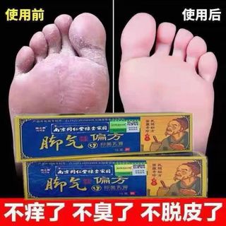 Kem trị nứt nẻ, viêm ngứa tay chân cùng các bệnh lý khác về da ( Hàng Giá Tận Xưởng )