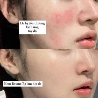Phục hồi da La Roche Posay B5