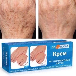 Kem nám đồi mồi Nga Kpem