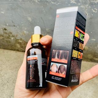 Serum Tinh Chất Mọc Tóc Giảm Gàu ORIGINAL, Tinh Chất Kích Thích Mọc Tóc Giảm Gàu, Nấm Ngứa , Bảo Vê Nang Tóc Chắc Khoẻ