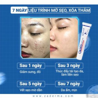Gel Mờ Sẹo Zaderma Scar Gel 7D - Hỗ trợ mờ sẹo, giảm thâm, dưỡng ẩm 20G