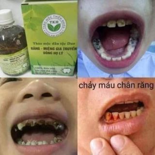 THẢO MỘC RĂNG MIỆNG TKH