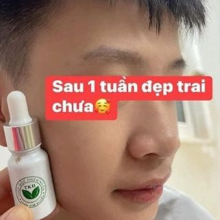 SERUM MỤN SÂM NGỌC LINH TKH