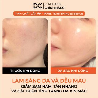 Tinh Chất DC Acnes Essence 30ml