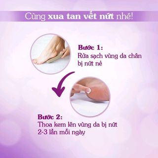 Kem giảm nứt gót chân Oriss 30g