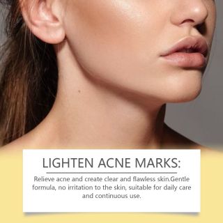 Bông Nén Tẩy Trang, khăn nén tẩy trang Numbuzin No.5 Vitamin-niacinamide làm sạch da trong 1lần, ngăn ngừa các loại mụn, se khít lỗ chân lông. ( Hàng Giá Tận Xưởng)