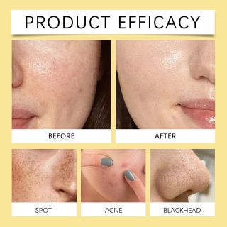 Bông Nén Tẩy Trang, khăn nén tẩy trang Numbuzin No.5 Vitamin-niacinamide làm sạch da trong 1lần, ngăn ngừa các loại mụn, se khít lỗ chân lông. ( Hàng Giá Tận Xưởng)