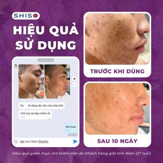 Gel giảm mụn thâm Shisofix