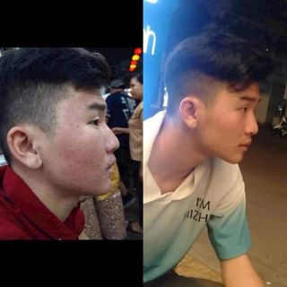 Sỉ Combo 3 Chai LINH CHI VI MỤN - [Mẫu mới] của Công ty Mỹ Phẩm Thanh Trang