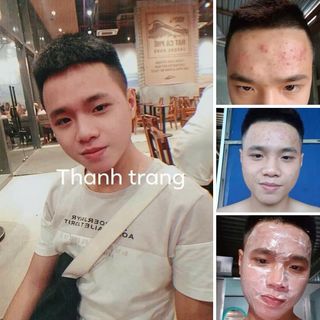 Sỉ Combo 3 Chai LINH CHI VI MỤN - [Mẫu mới] của Công ty Mỹ Phẩm Thanh Trang