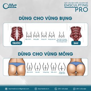 Máy làm săn chắc cơ giảm mỡ 4 tay cầm (EMS-IV)