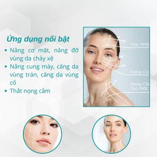 Chỉ nâng cơ PCL SPCL + PCL Mesh + PCL EP Cog : 18G*100mm