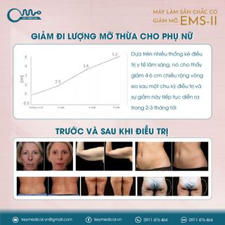 Máy làm săn chắc cơ giảm mỡ (EMS-II)