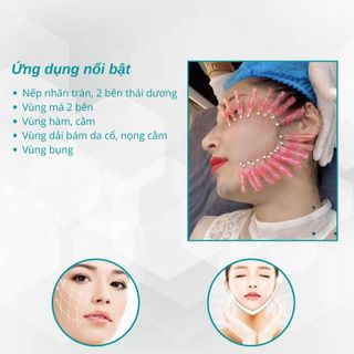 Chỉ Làm đầy và trẻ hoá da PDO Mono: 29*40mm