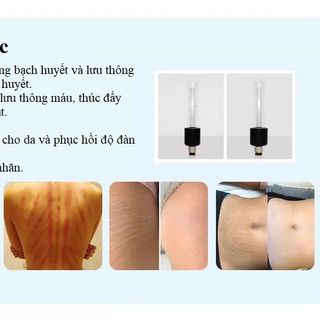 Máy giảm béo Vacuum Newest Fat TB55B