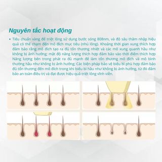 Máy triệt lông Diode Laser Horizontal 808nm