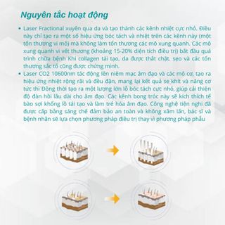 Máy điều trị sẹo 10600KKLB Ultra Pulse Laser Co2 Fractional