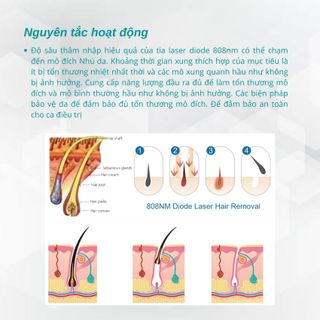 Máy triệt lông Diode laser 808KK-1200