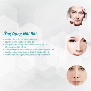 Máy phi kim điều trị sẹo RF Fractional Microdermabrasion TB88