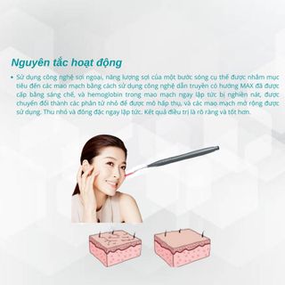 Máy điều trị mao mạch 980KL công nghệ 980nm