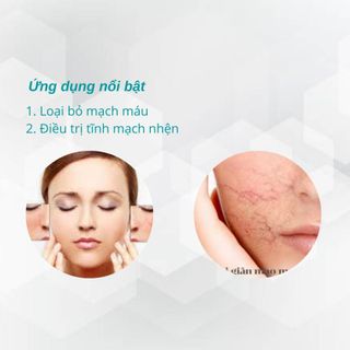 Máy điều trị mao mạch 980KL công nghệ 980nm