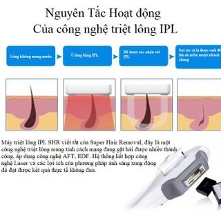 Máy xoá xăm điều trị sắc tố NdYAG kết hợp triệt lông IPL TB762