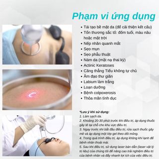 Máy Laser Co2 Fractional Sanhe SC-2
