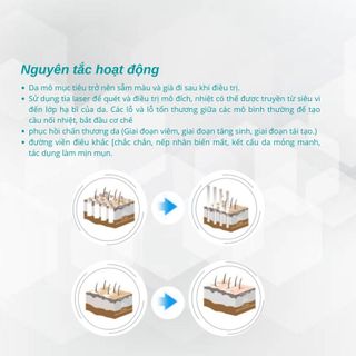 Máy laser Co2 Fractional điều trị sẹo, trẻ hoá âm đạo SM10600CHb