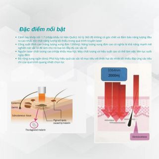 Máy điều trị nám xoá xăm 1064QCCL công nghệ Q-Switched Nd:YAG