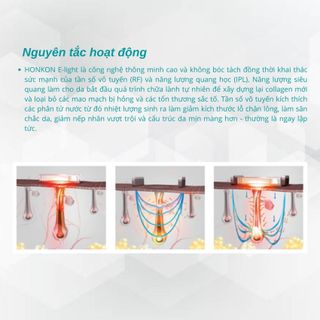 Máy triệt lông M90E-300 công nghệ IPL Elight