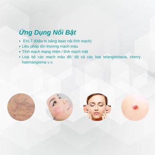 Máy điều trị mao mạch máu SP1700