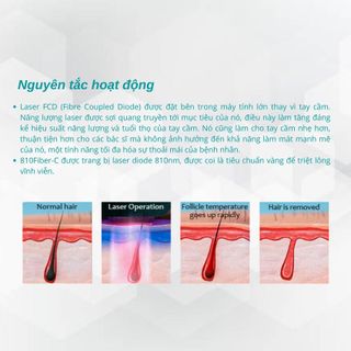 Máy triệt lông Diode Laser 808nm 810Fiber