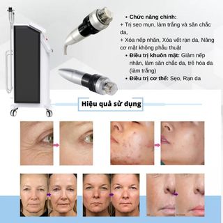 Sanhe Beauty PINXEL-2 Thiết bị RF phân đoạn trị sẹo, xóa nếp nhăn