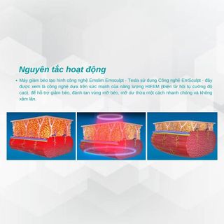 Máy giảm béo tạo hình công nghệ Emslim Emsculpt - Tesla