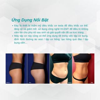 Máy giảm béo tạo hình công nghệ Emslim Emsculpt - Tesla