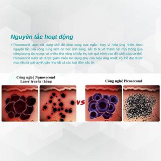 Máy xoá xăm, trị nám công nghệ Picosecond tay cầm hàn quốc 7 đốt - SP1201