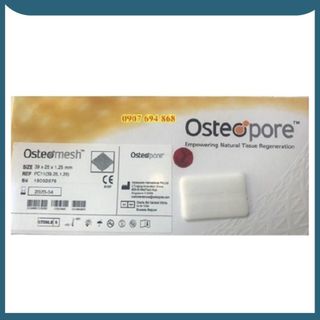 Dựng trụ mũi OSTEOMESH