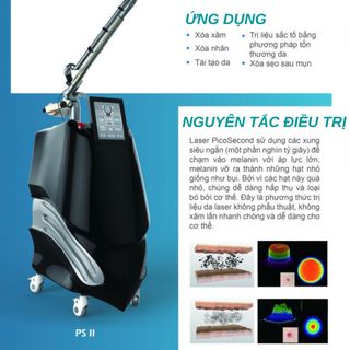 Máy trị nám 850ps picosecond laser (PS II)