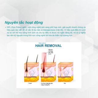 Máy triệt lông trẻ hoá da, ánh sáng Photon + DPL SP1107