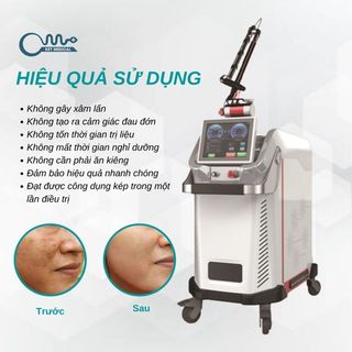Máy trị nám da 450ps picosecond laser (PicoFocus)