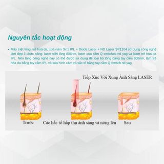 Máy triệt lông, trẻ hoá da, xoá nám 3in1 IPL + Diode Laser + ND Laser SP1104