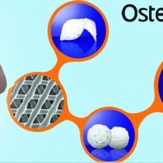 Vật liệu cấy ghép trong nâng mũi (2 miếng rời) (OSTEOMESH PCL TWIN)