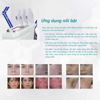 Máy triệt lông 3 tay cầm IPL (NBW-I323)