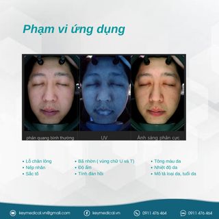 Máy phân tích da A-ONE Smart Hàn Quốc