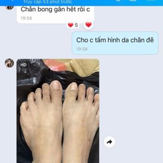 Peel da body retinol hmstore giá bán sỉ