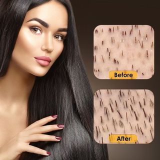 Chai xịt dưỡng kích mọc tóc, giúp tóc mọc dài nhiều và dày, mọc tóc nhanh, bóng, mượt, ngăn rụng tóc xuất xứ Singapore - Mã số 1102