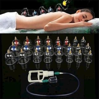 BỘ GIÁC HƠI KHÔNG DÙNG LỬA