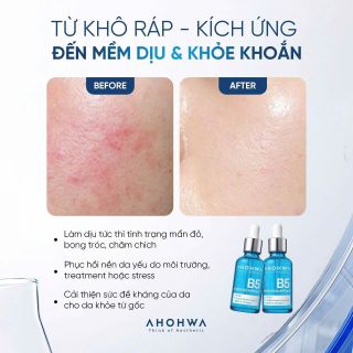 Serum B5 Ahohwa 50ml