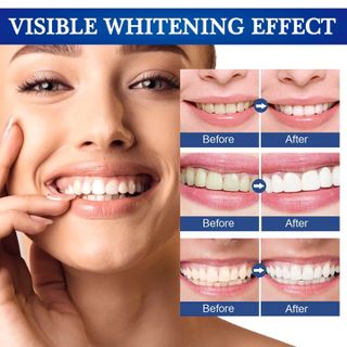 Gel bôi làm trắng, sáng răng, giảm ố vàng, cao răng, giảm hôi miệng và giúp hơi thở thơm tho xuất xứ Nhật Bản – Mã số 1223